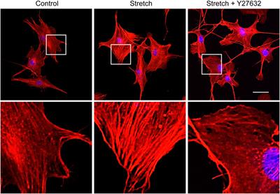 YAP mechanotransduction under cyclic mechanical stretch loading for mesenchymal stem cell osteogenesis is regulated by ROCK